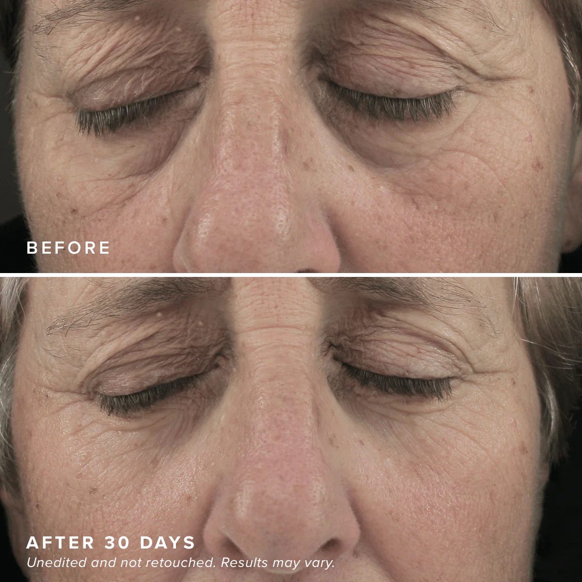 Brightening Eye Masks - Image 8