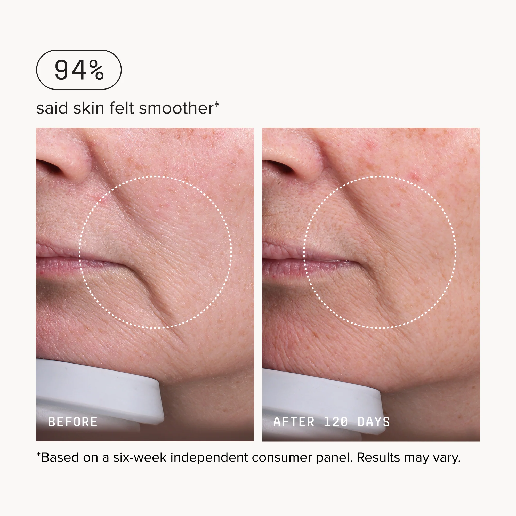 Needle-less® Serum - Image 14